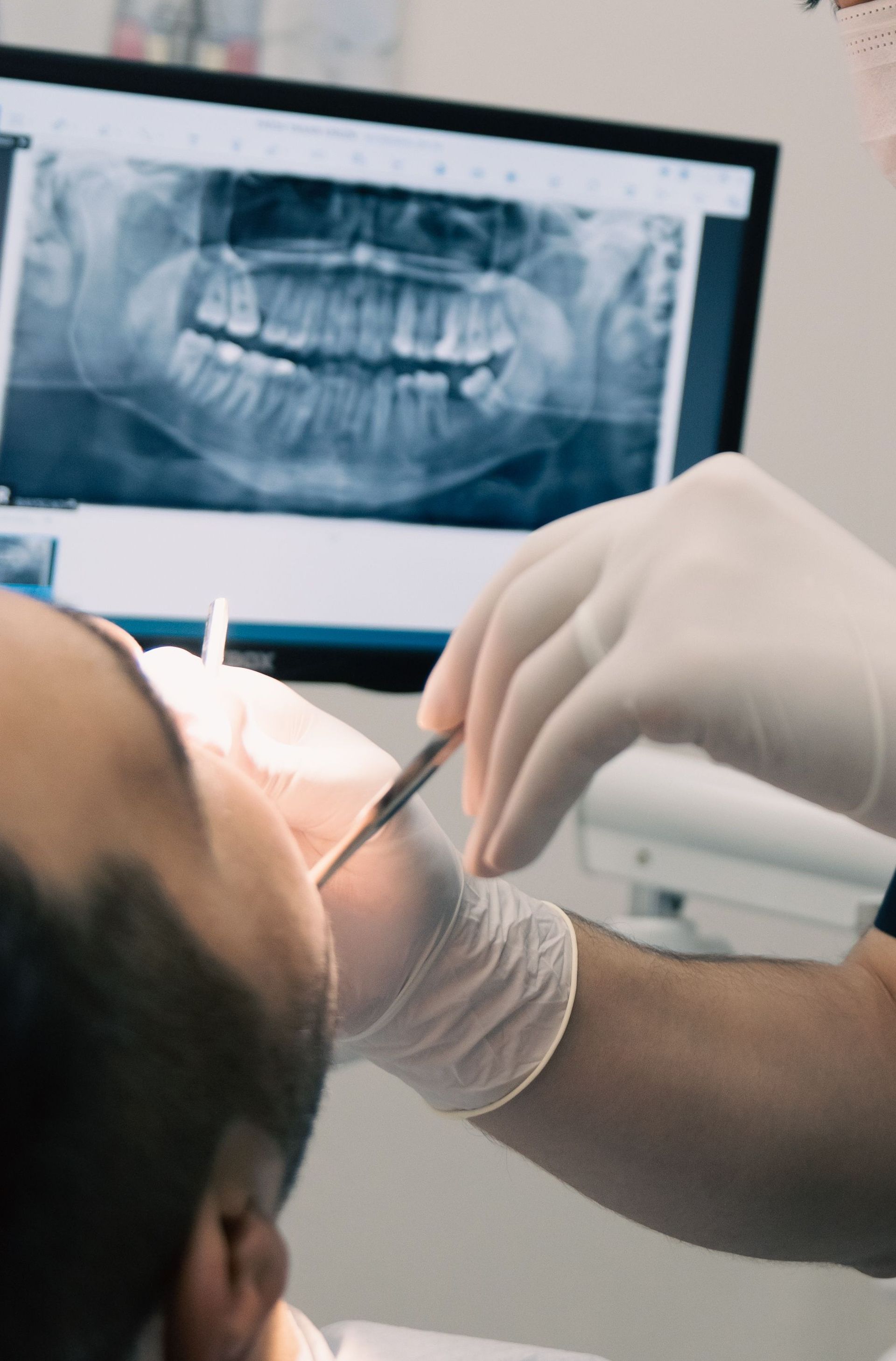 Dentist examining a patient’s mouth with tools, with a dental X-ray displayed in the background.