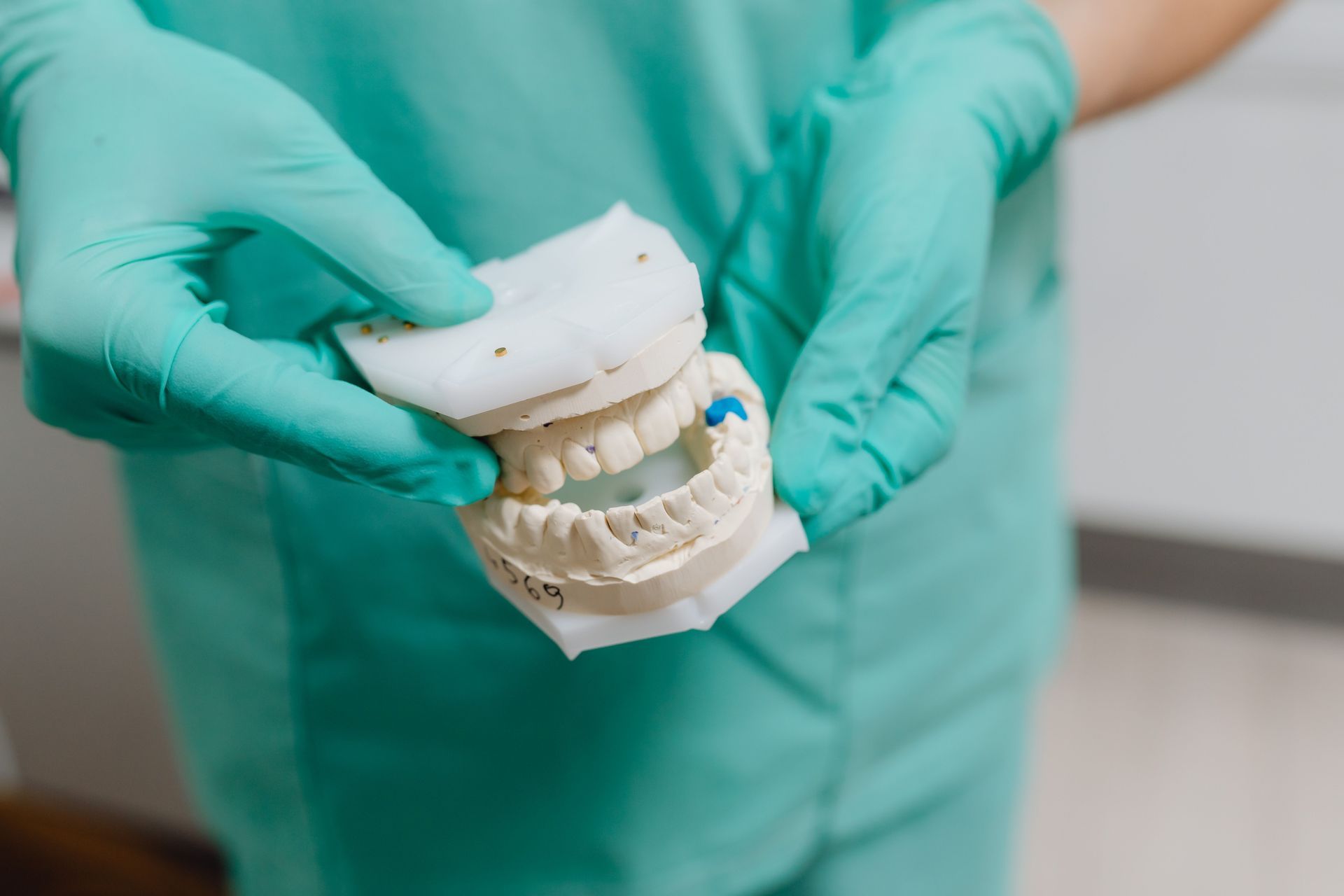 Gloved hands holding a dental mold with a white impression tray and teeth model.
