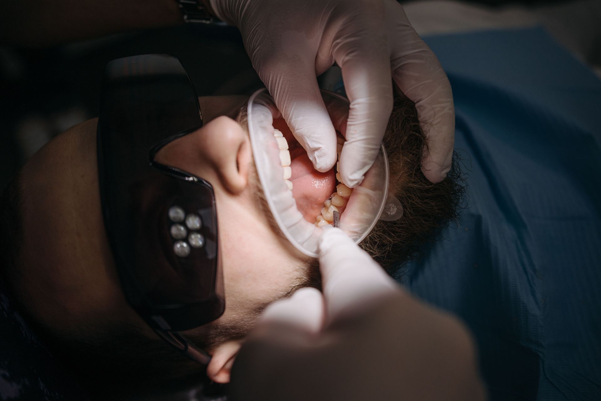 Dentist using gloved hands and tools to examine a patient’s open mouth during a procedure.
