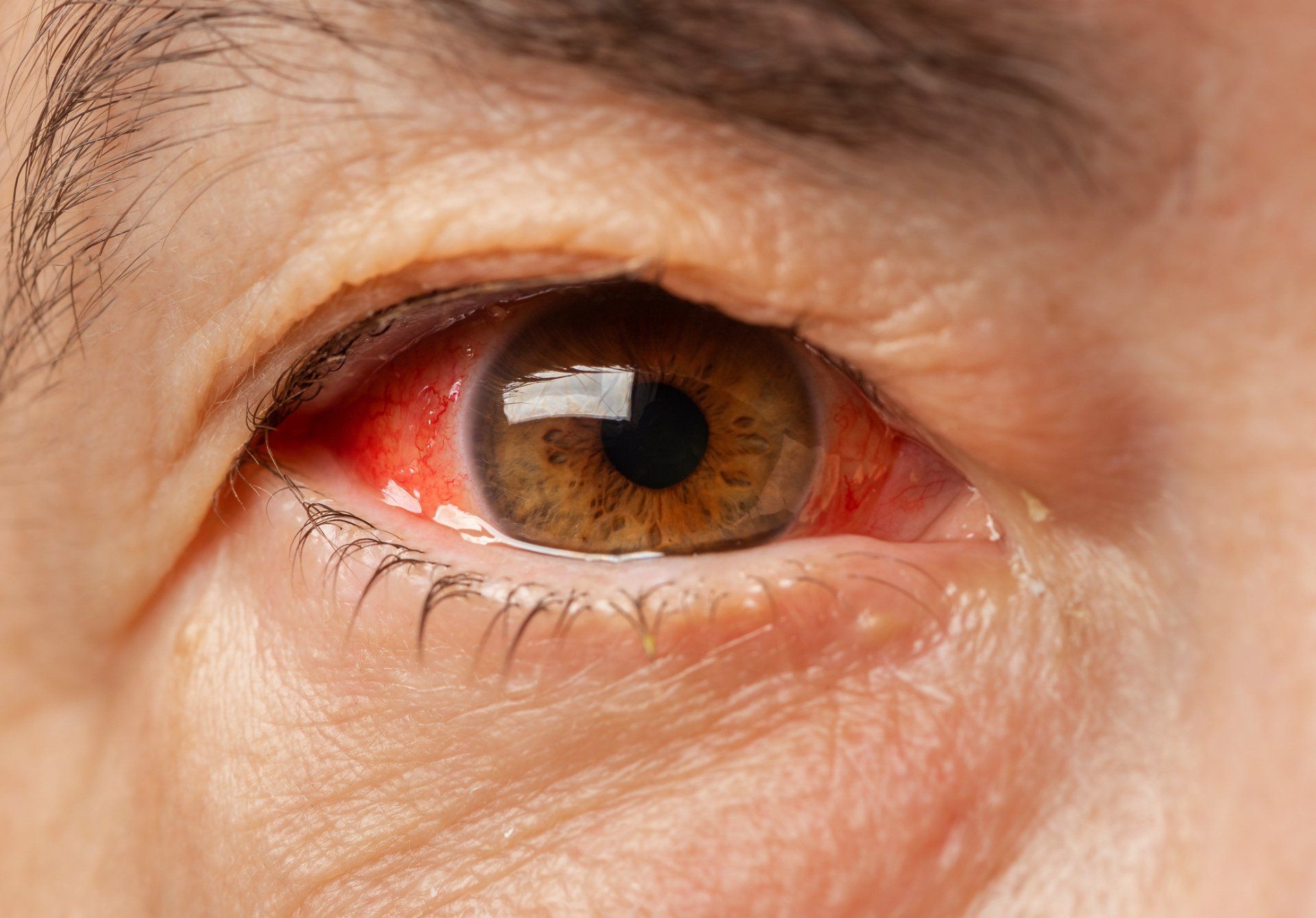 Examining Patient's Eyes - Tupelo, MS - Tupelo Eye Center Examining Patient's Eyes - Tupelo, MS - Tupelo Eye Center