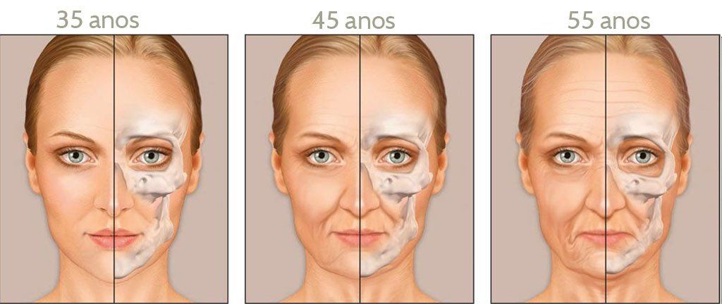 O rosto de uma mulher é mostrado em três estágios diferentes de envelhecimento.