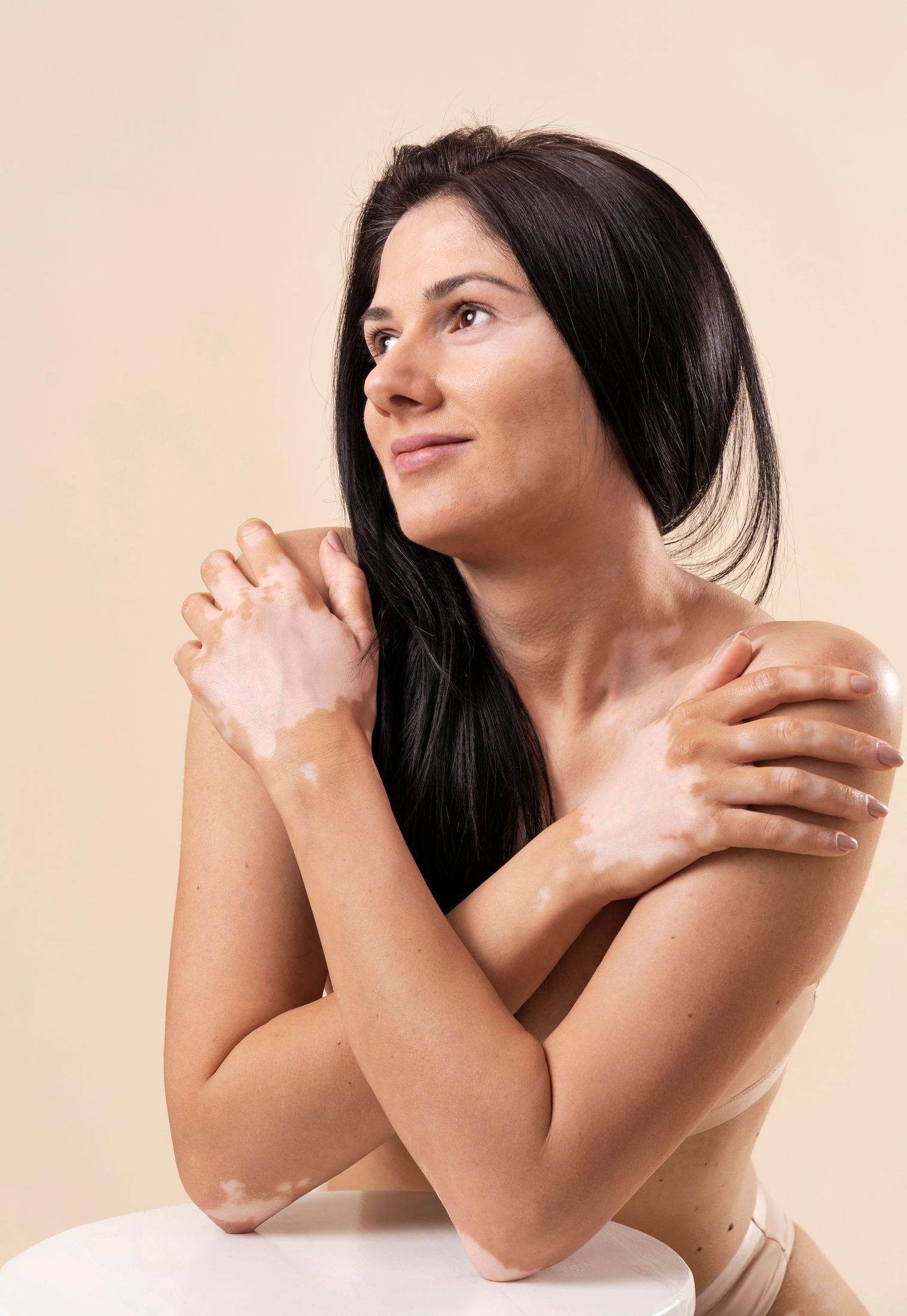 Uma mulher com vitiligo está sentada em uma cadeira com os braços cruzados.
