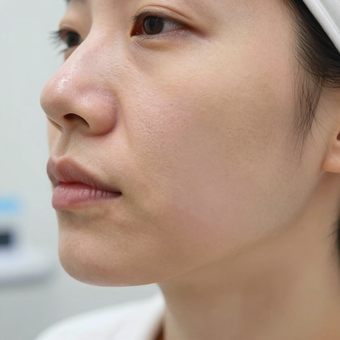Close-up profile of a person with smooth skin in a bright clinical setting