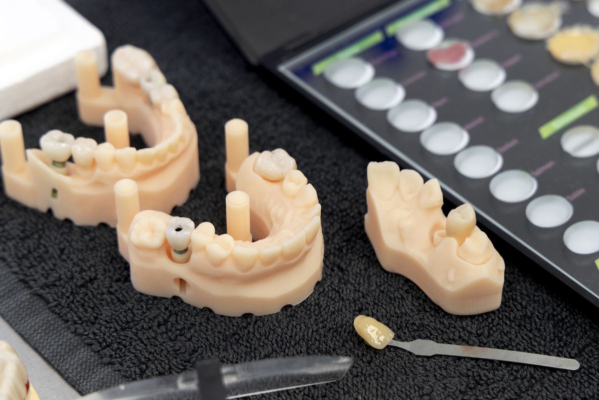 Dental prosthetics models and tools on a black workbench beside a color chart.