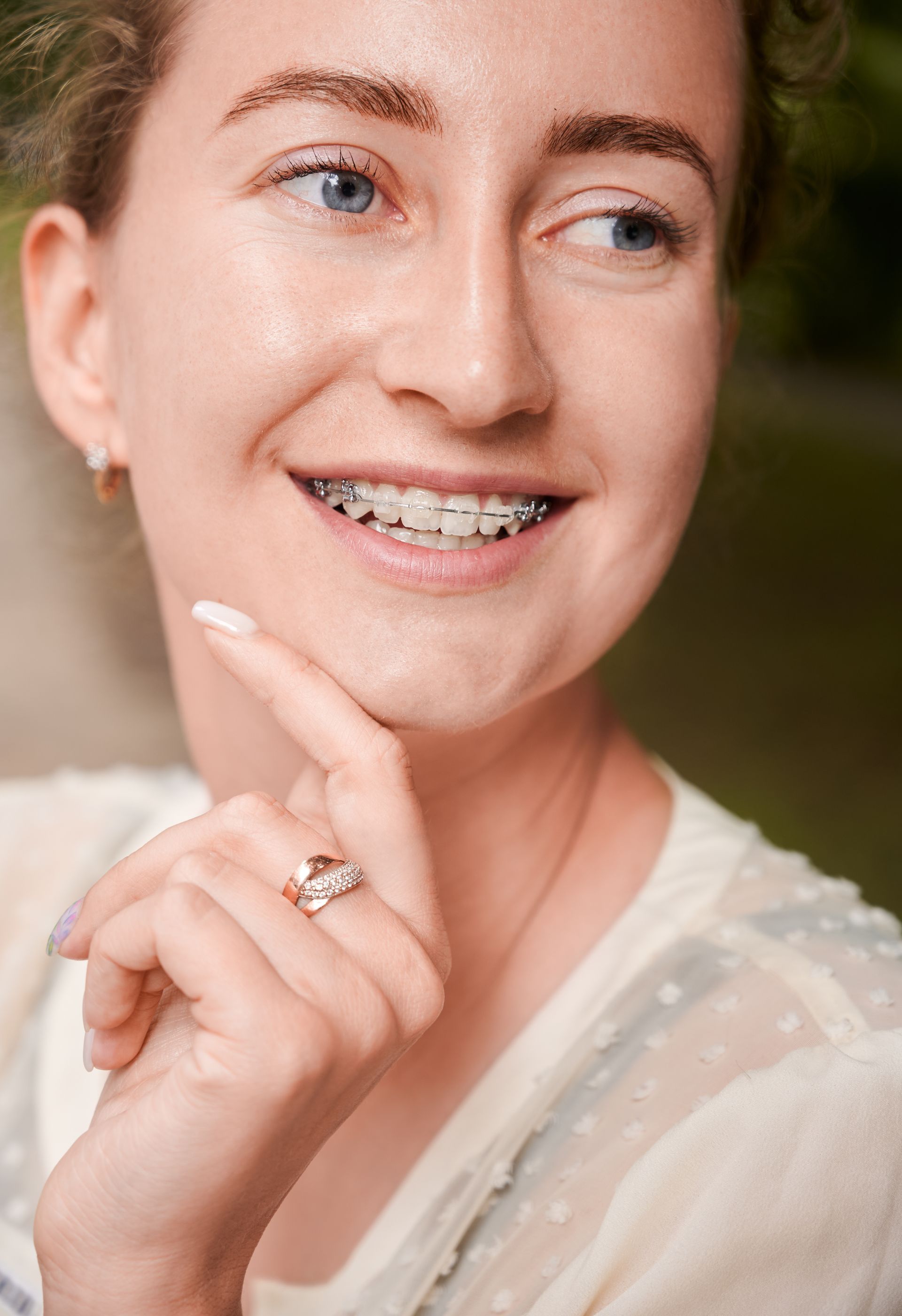 A woman with braces and a ring on her finger is smiling.