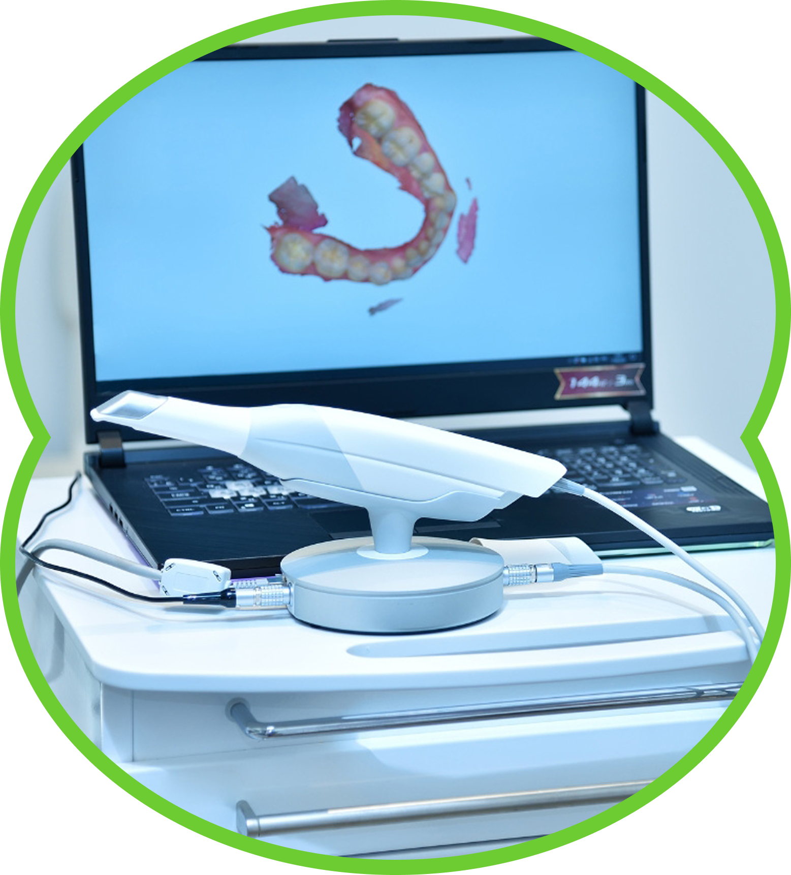 Dental scanner on a laptop displaying a 3D dental model, on a white desk with cables.