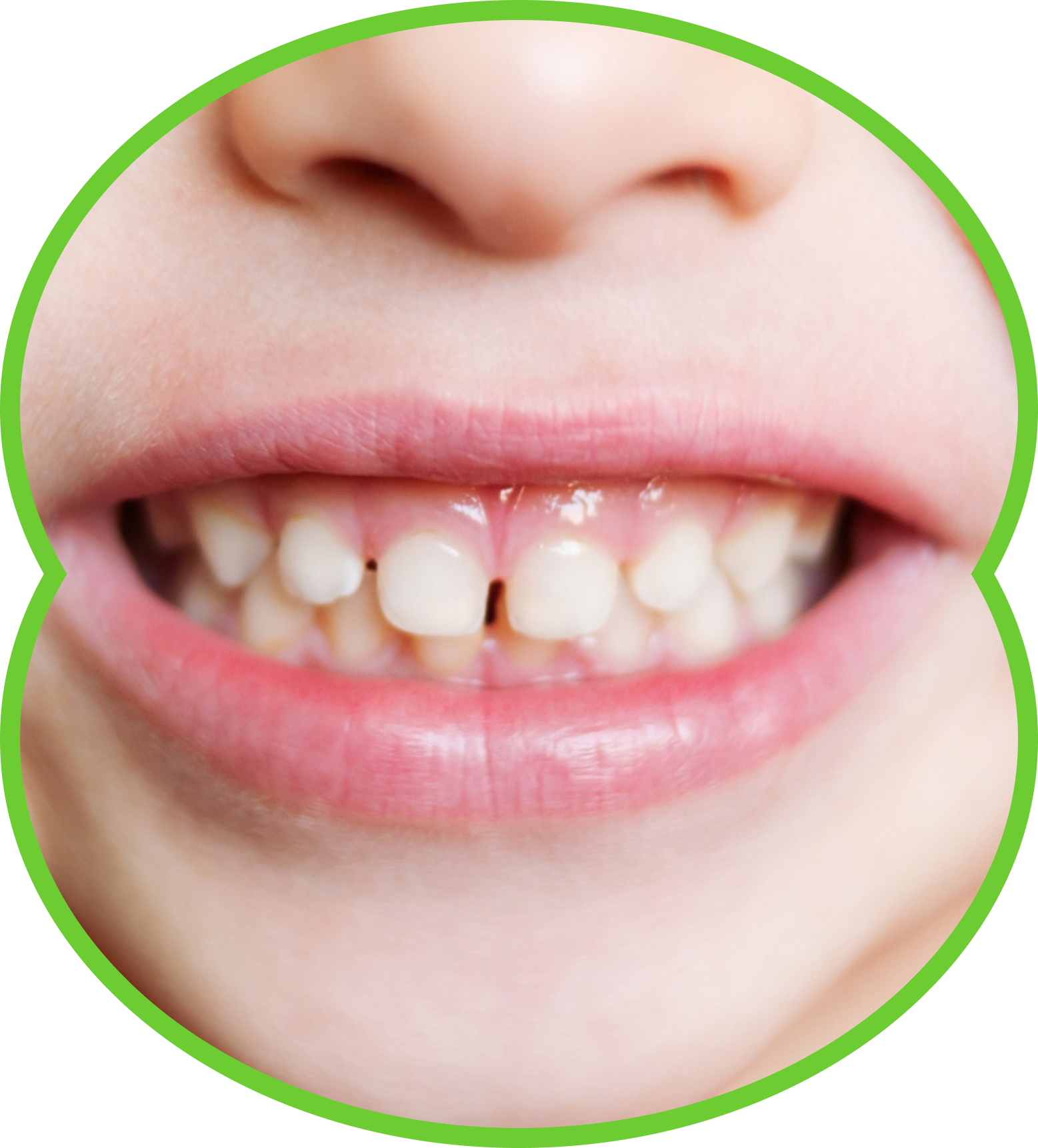 Close-up of a smiling mouth with visible teeth and pink lips inside a green circle outline