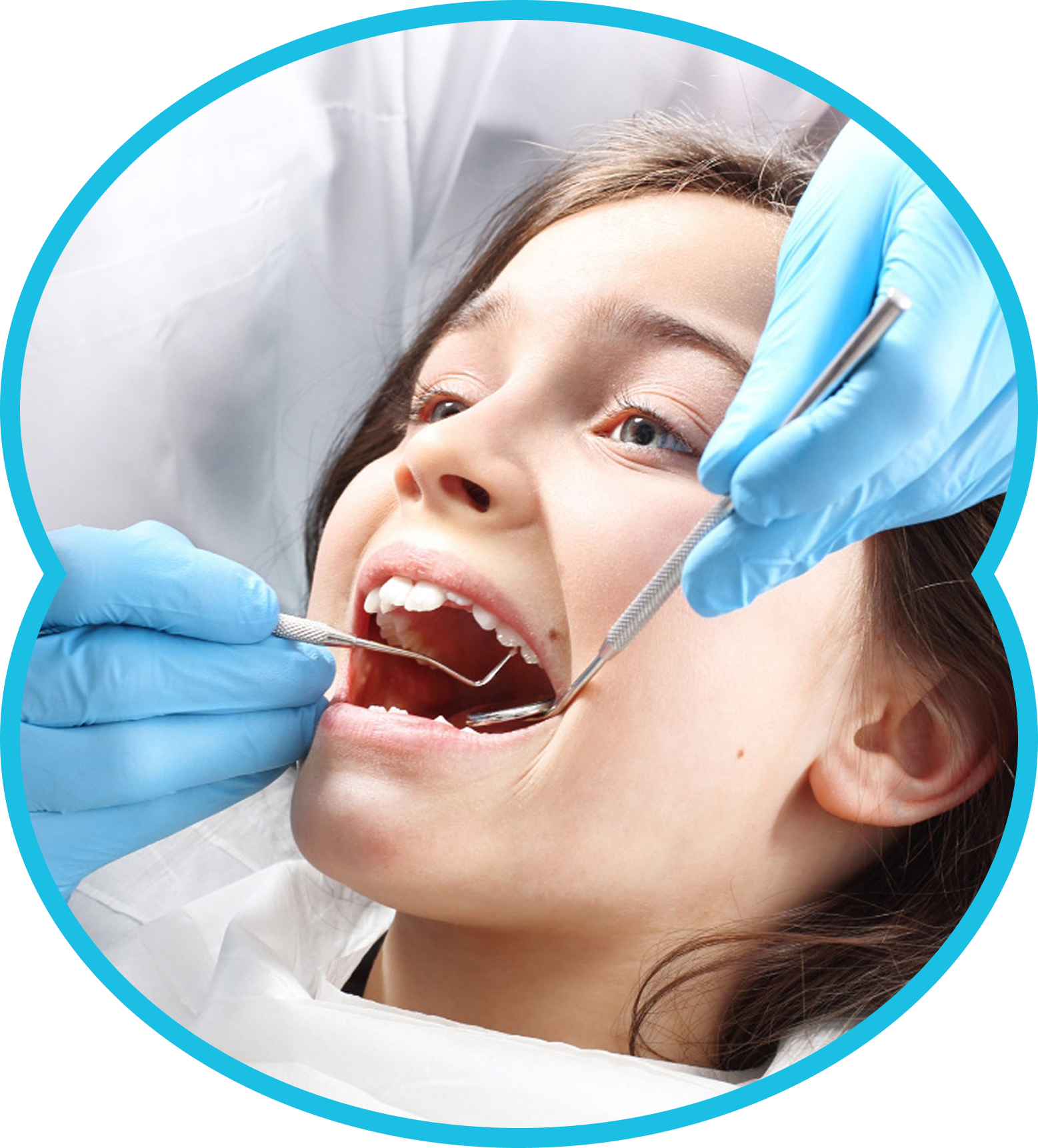 Dentist examining a patient’s open mouth with dental tools and blue gloves