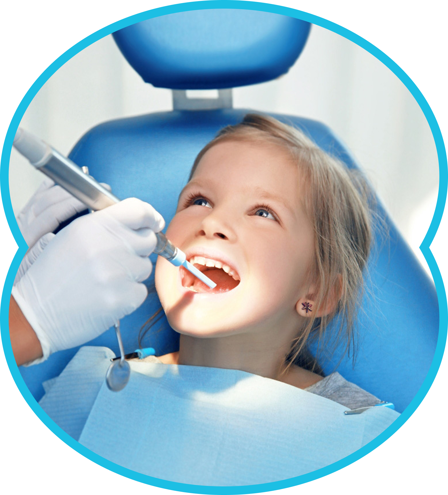 Child smiling in a dental chair while a dentist examines teeth with a mirror and gloved hand.