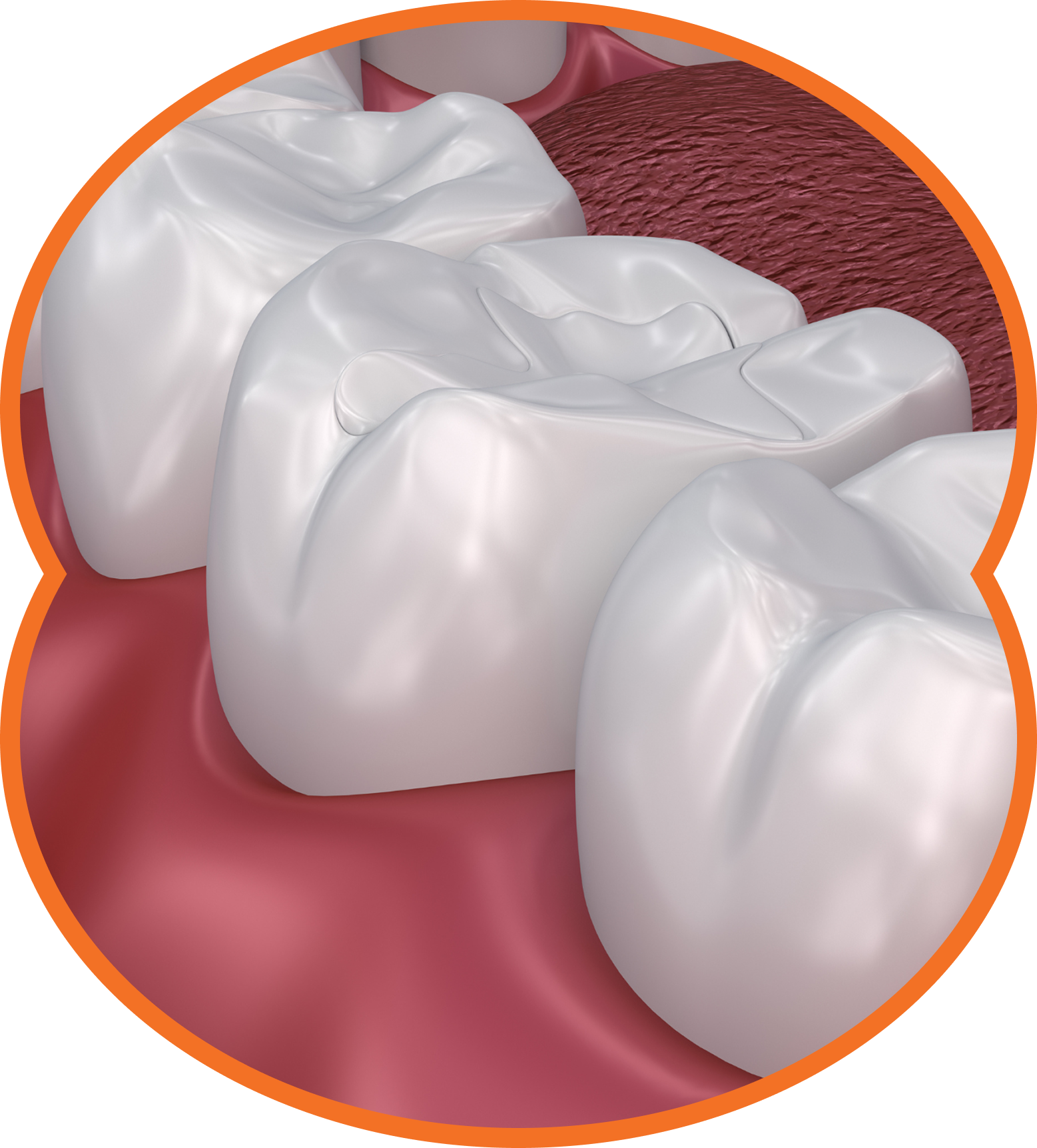 3D illustration of white molars and gums, showing a close-up side view of teeth