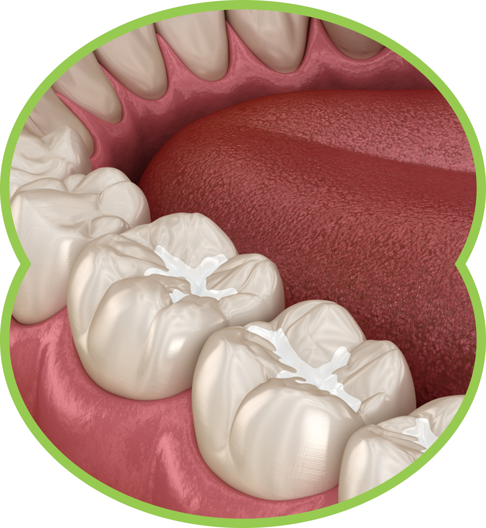 Illustration of white molars and pink gums inside a mouth, viewed close up