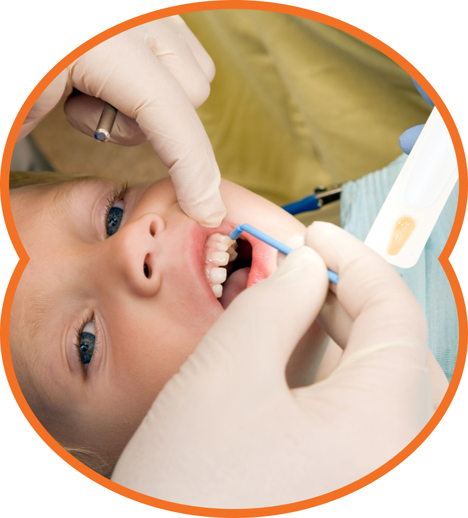 Dentist cleaning a child’s teeth with gloved hands and dental tools