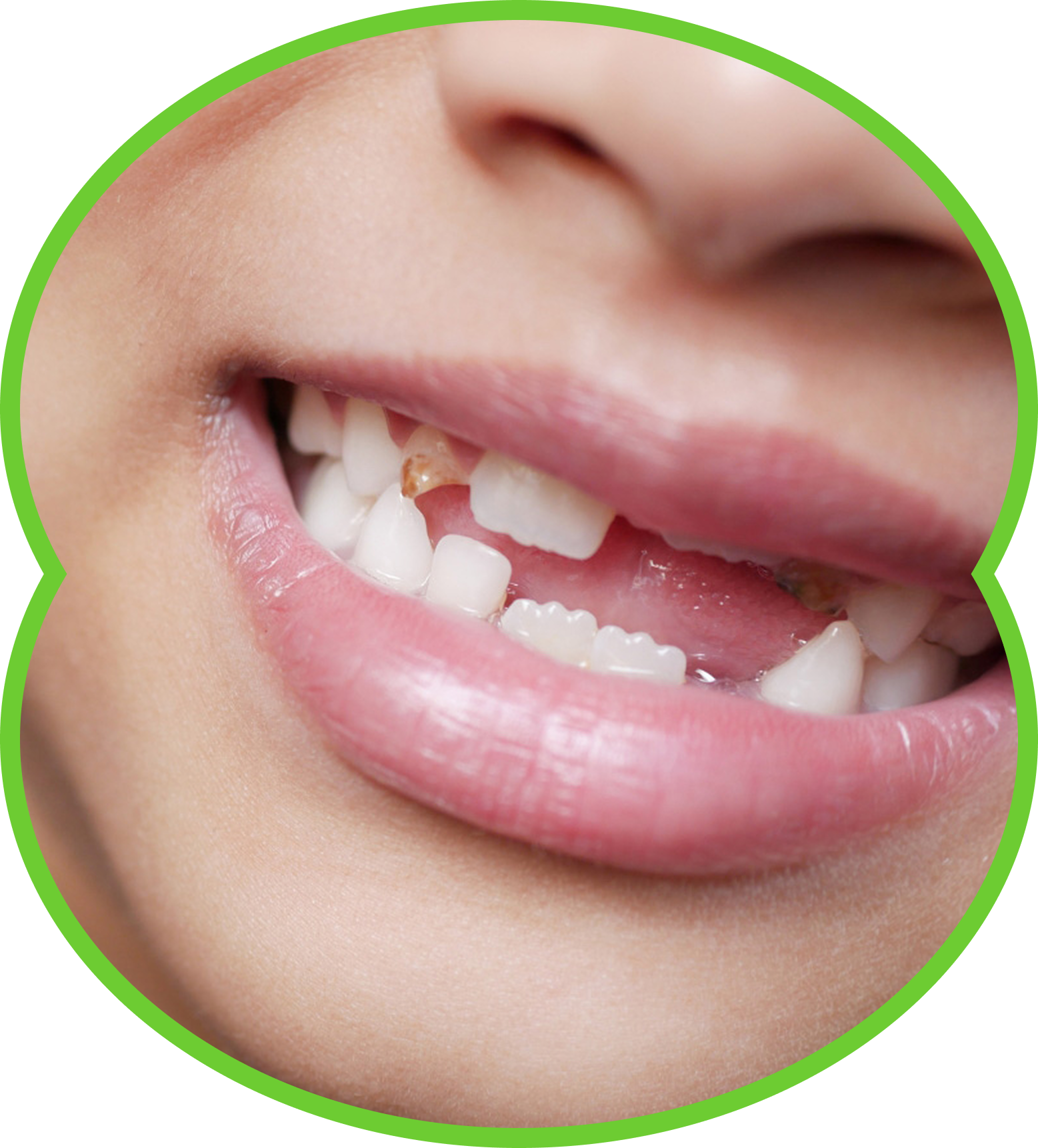 Close-up of a smiling mouth with a visible gold tooth and white teeth.