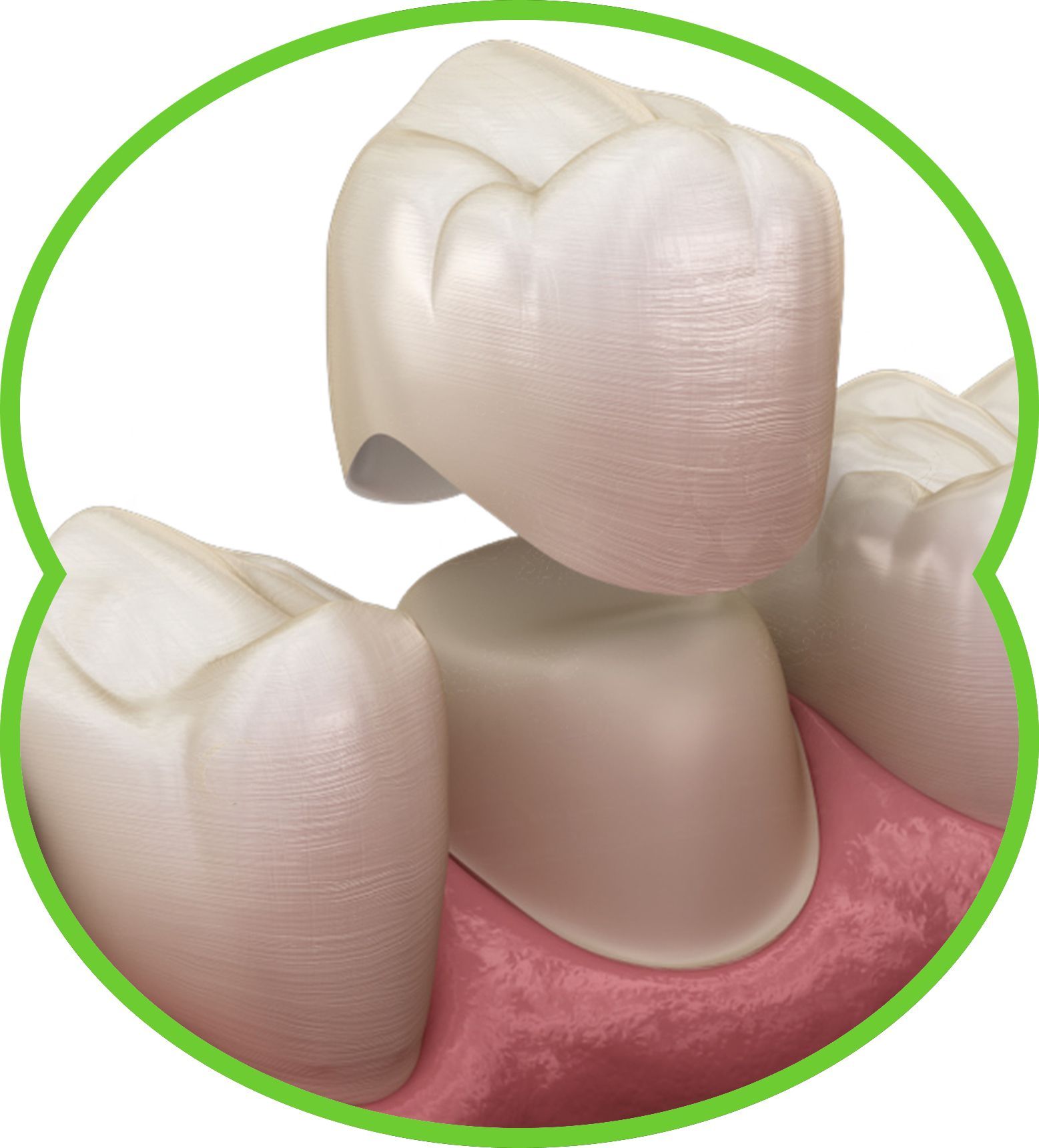Close-up illustration of three white teeth and pink gums in a green circle