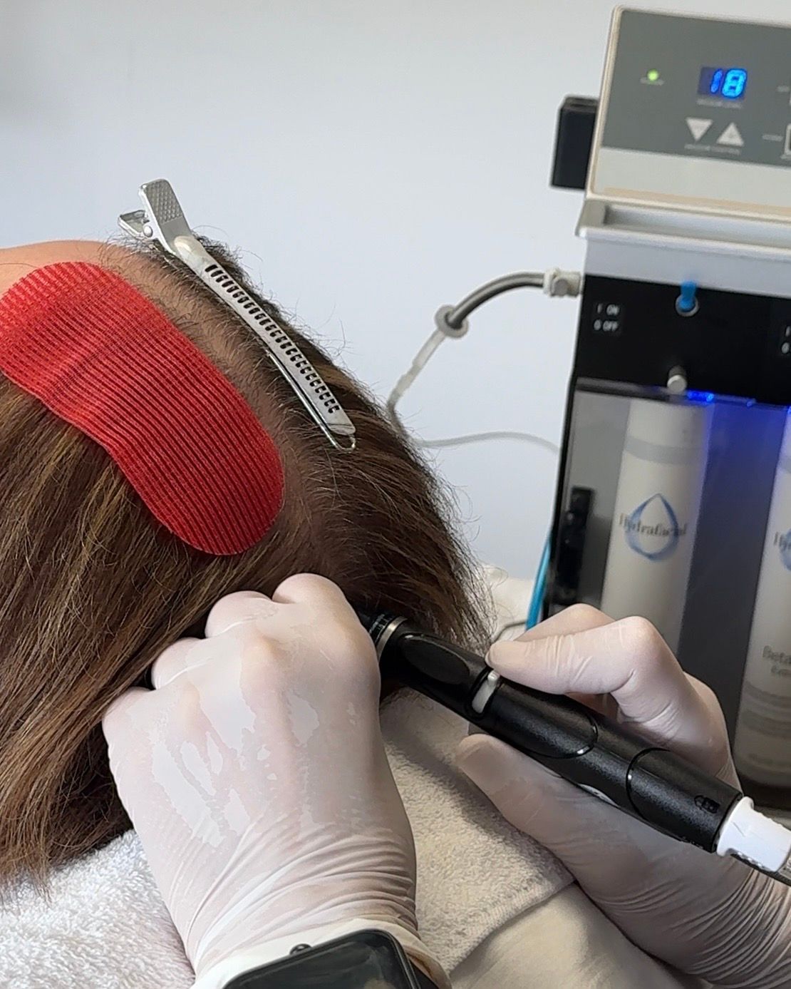 Gloved clinician using a black handheld device on a patient’s scalp beside a machine with blue display