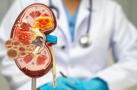 How Hydration Supports Kidney Health | Metropolitan Kidney Centers