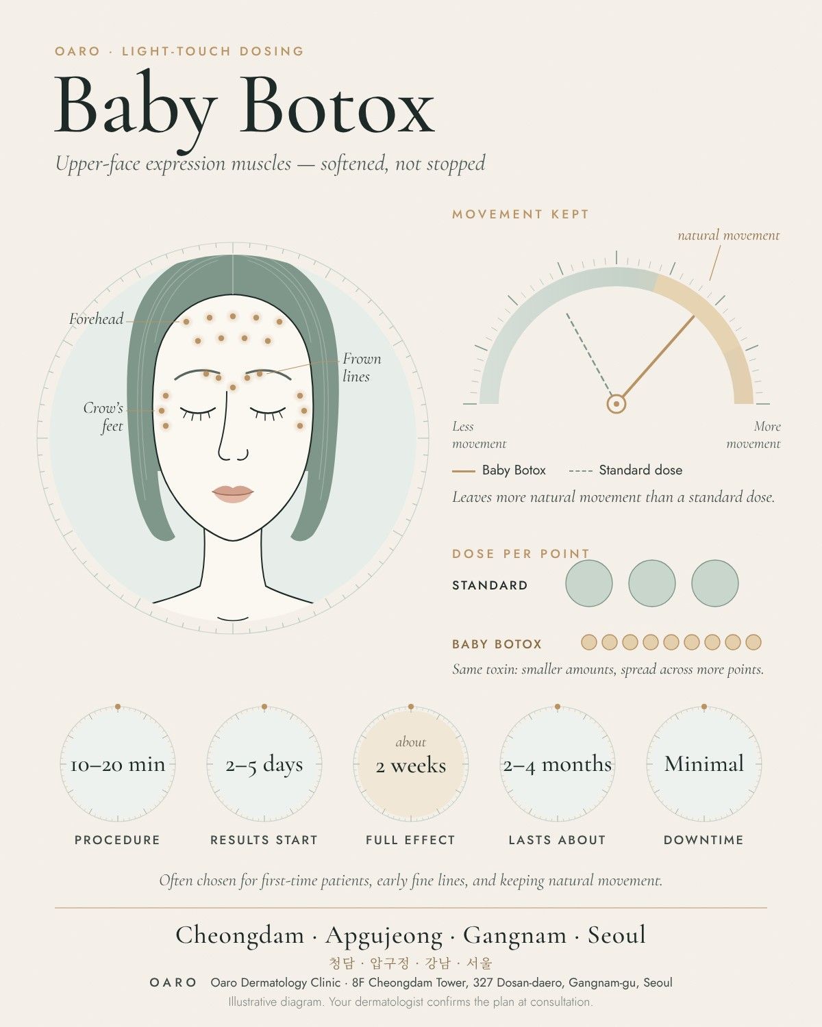 Baby Botox illustrated guide, Oaro Dermatology in Cheongdam & Apgujeong, Gangnam, Seoul