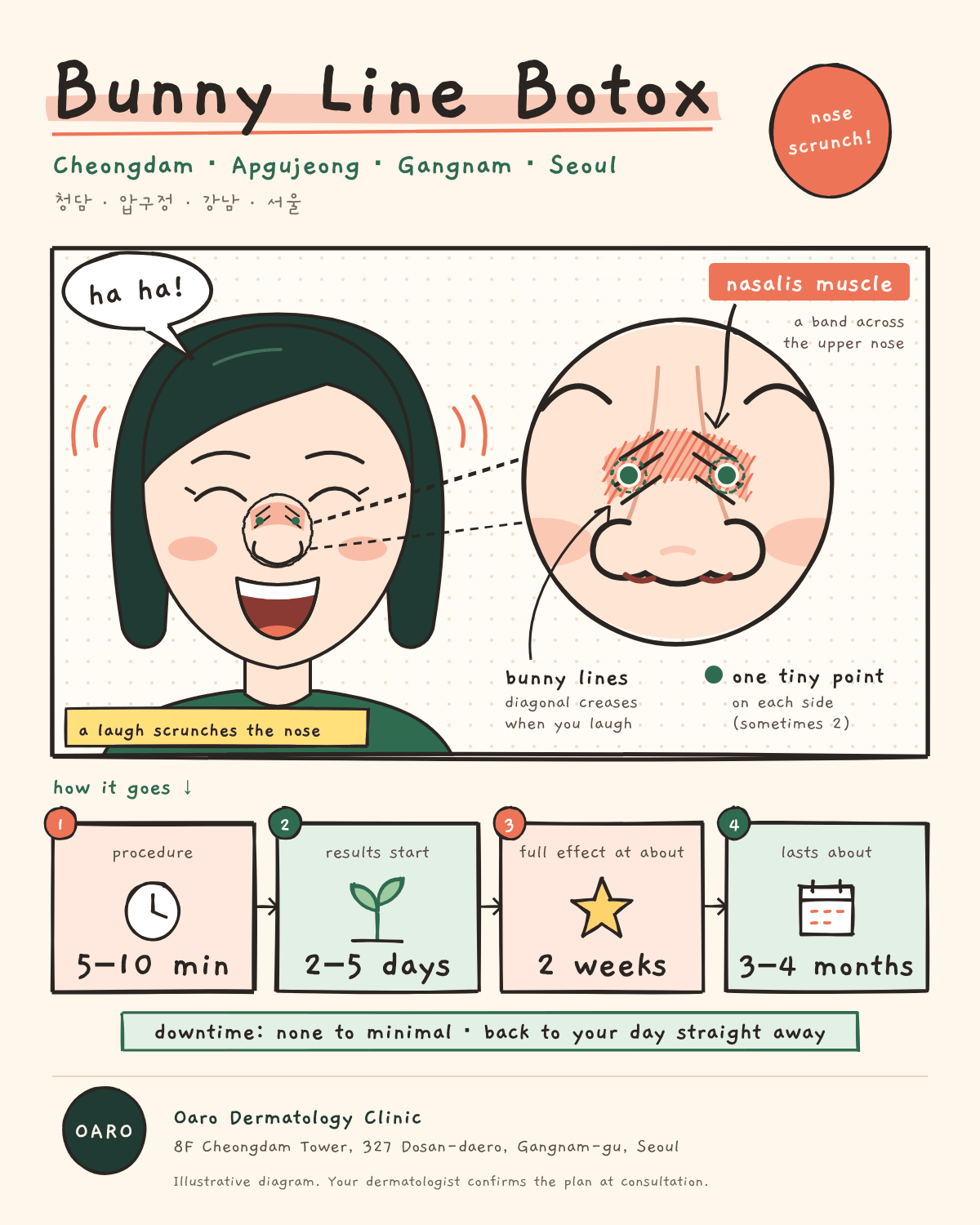 Bunny Line Botox illustrated guide, Oaro Dermatology in Cheongdam & Apgujeong, Gangnam, Seoul