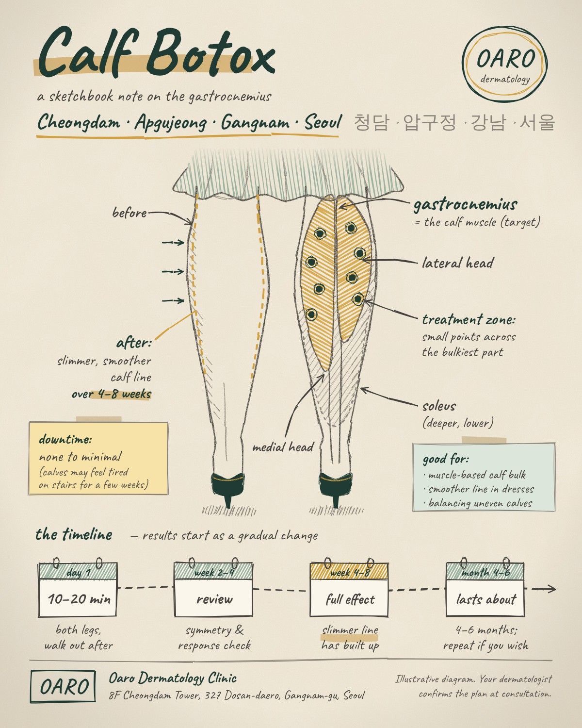 Calf Botox illustrated guide, Oaro Dermatology in Cheongdam & Apgujeong, Gangnam, Seoul