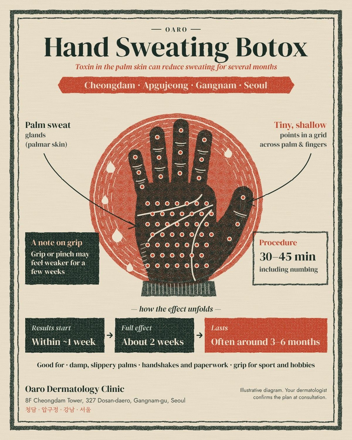 Hand Sweating Botox illustrated guide, Oaro Dermatology in Cheongdam & Apgujeong, Gangnam, Seoul