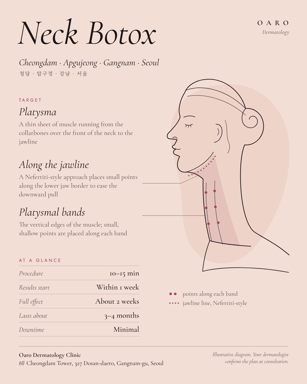 Neck Botox illustrated guide, Oaro Dermatology in Cheongdam & Apgujeong, Gangnam, Seoul