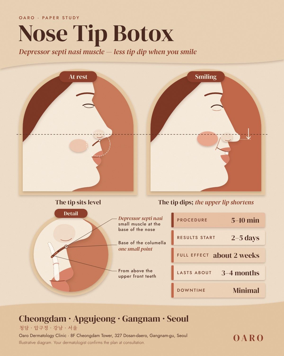 Nose Tip Botox illustrated guide, Oaro Dermatology in Cheongdam & Apgujeong, Gangnam, Seoul