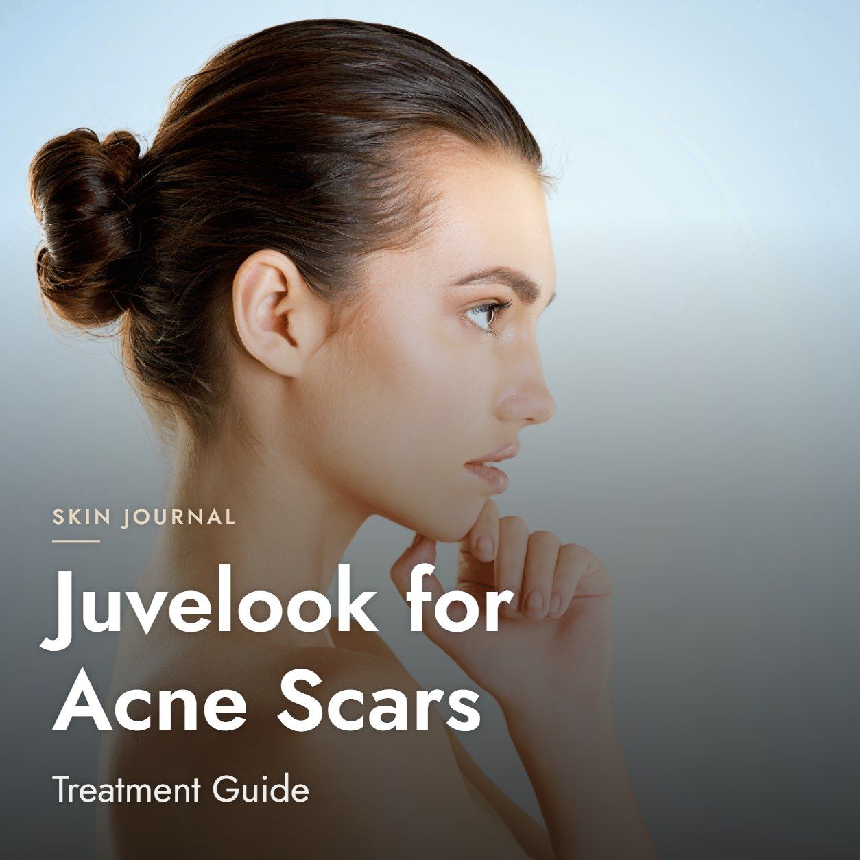 Juvelook for Acne Scars: Treatment Guide