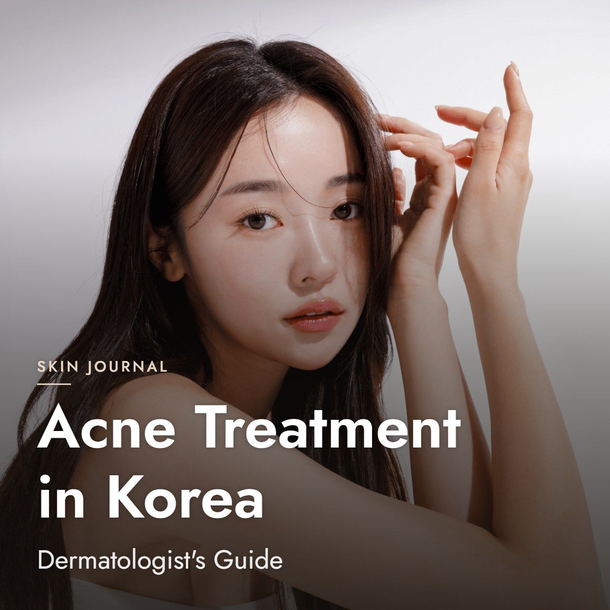 Acne Treatment in Korea: Dermatologist's Guide