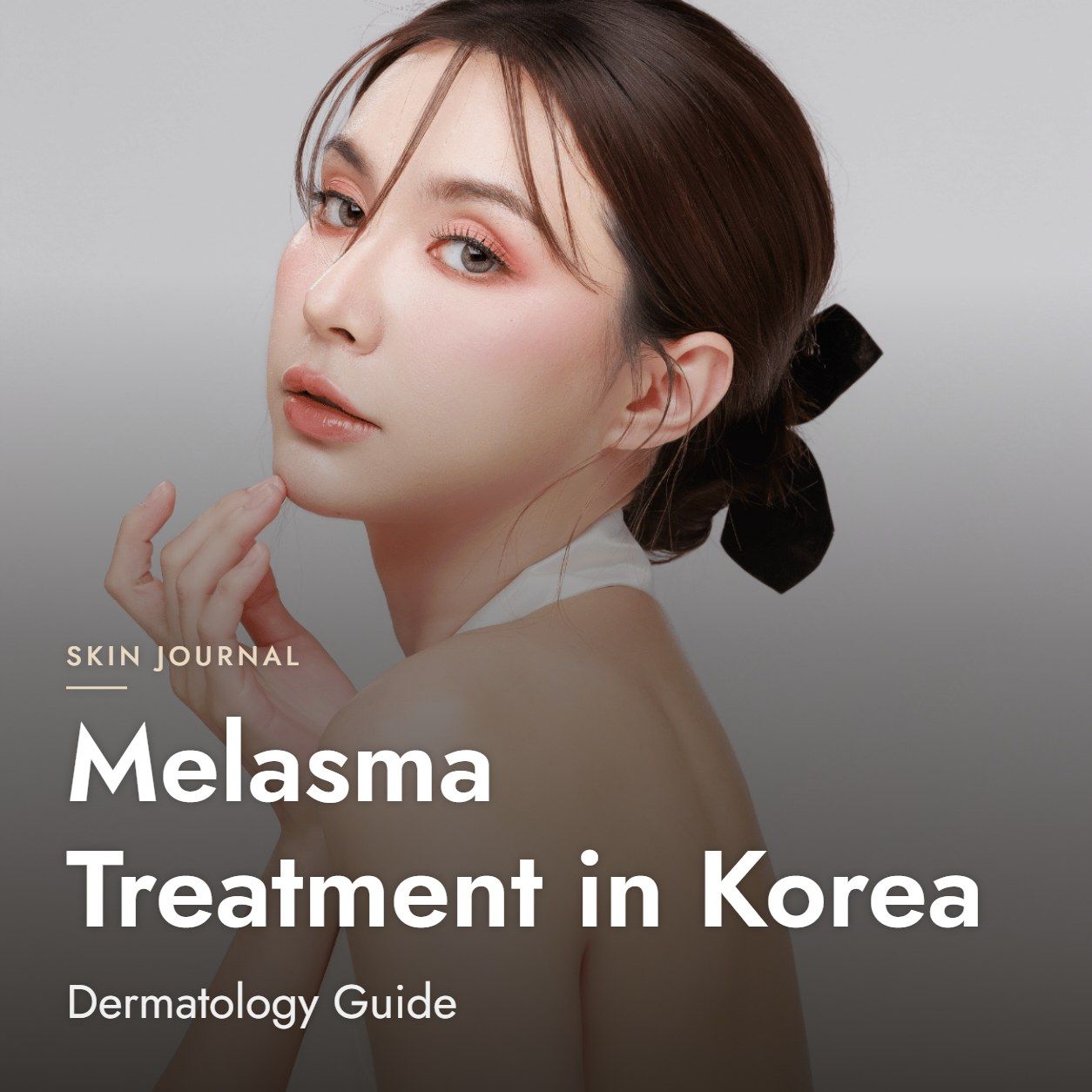 Melasma Treatment in Korea: Dermatology Guide