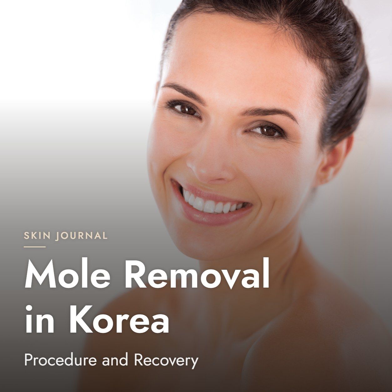 Mole Removal in Korea: Procedure and Recovery