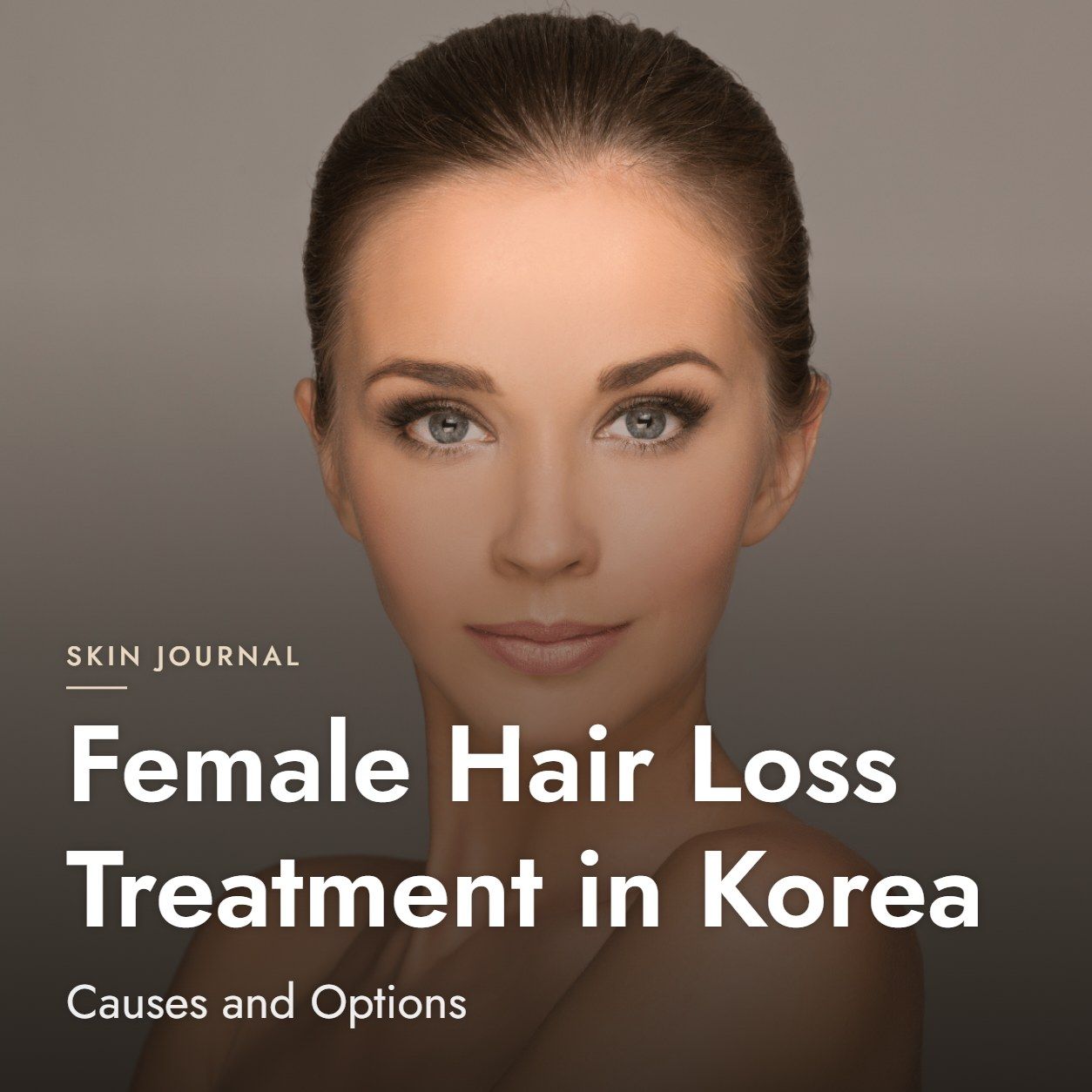 Female Hair Loss Treatment in Korea: Causes and Options