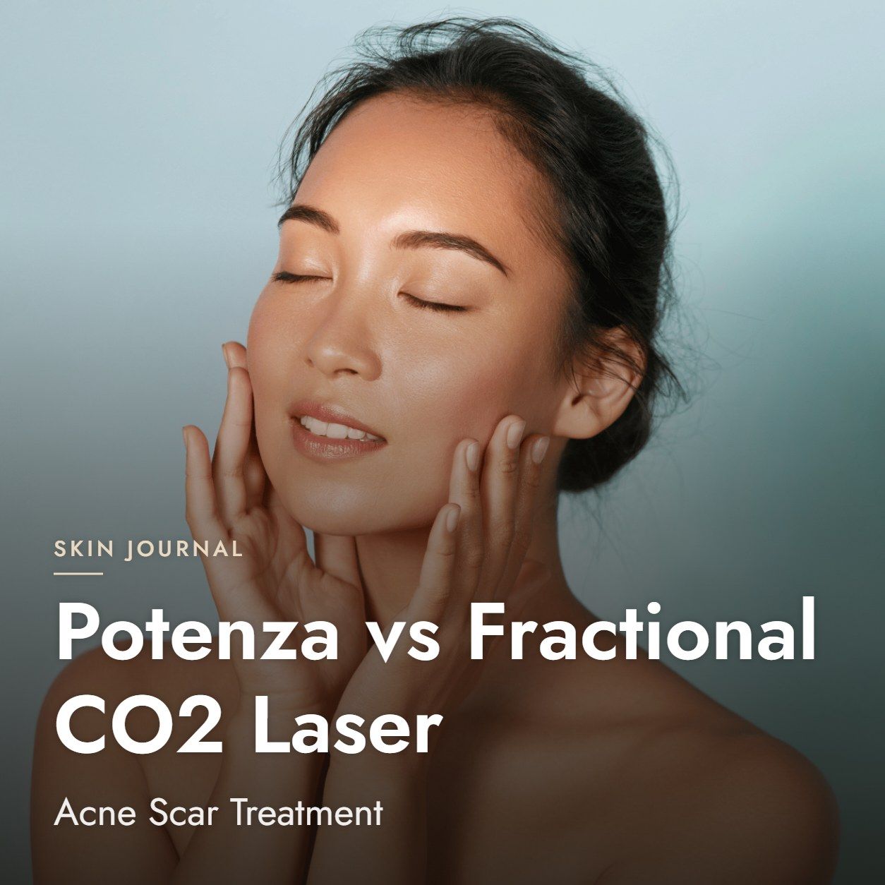 Potenza vs Fractional CO2 Laser: Acne Scar Treatment