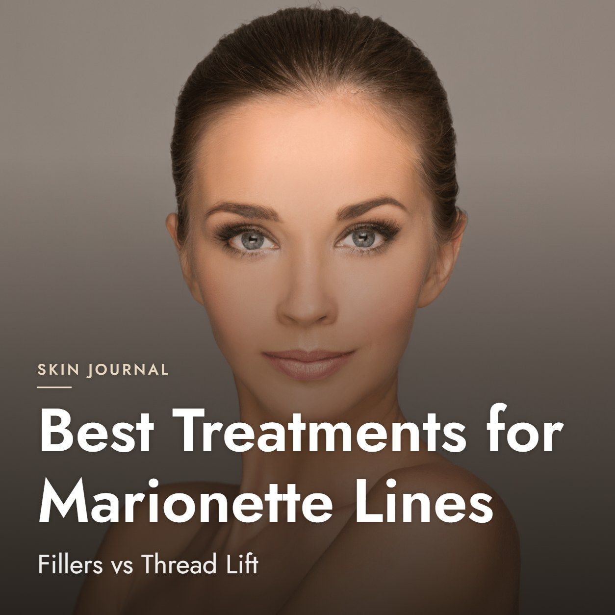 Best Treatments for Marionette Lines: Fillers vs Thread Lift