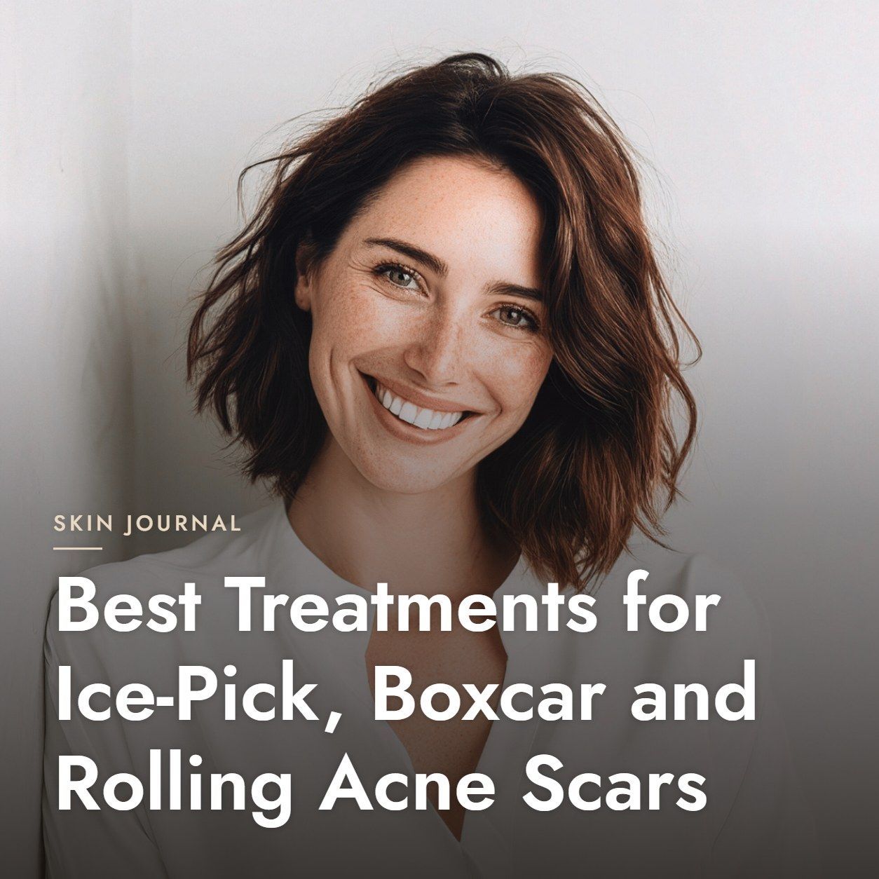 Best Treatments for Ice-Pick, Boxcar and Rolling Acne Scars