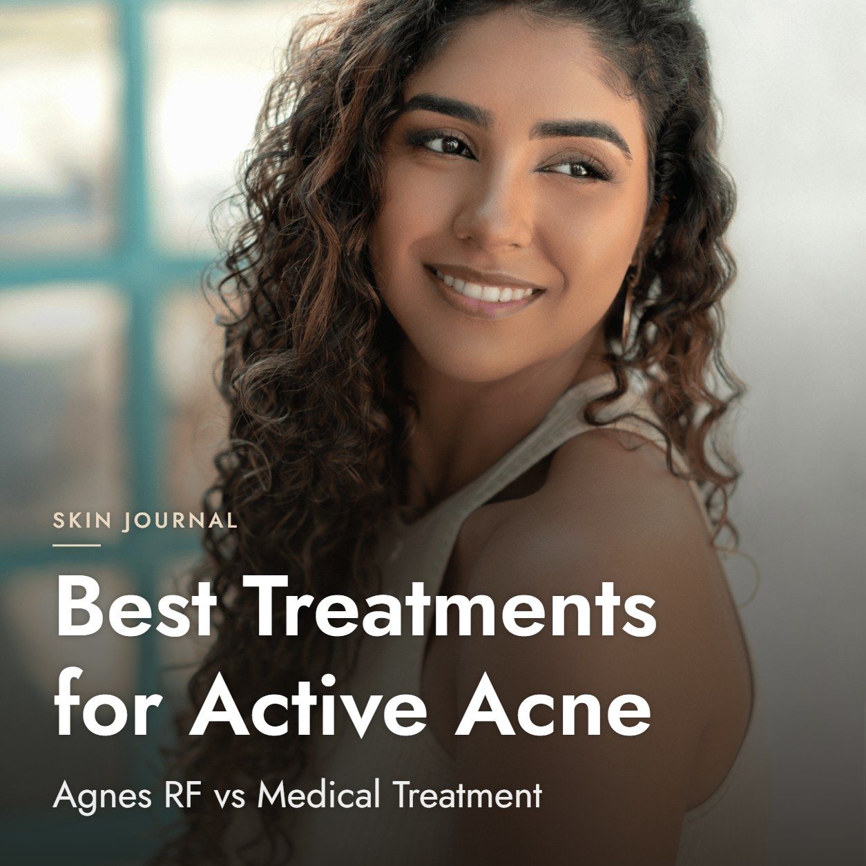 Best Treatments for Active Acne: Agnes RF vs Medical Treatment
