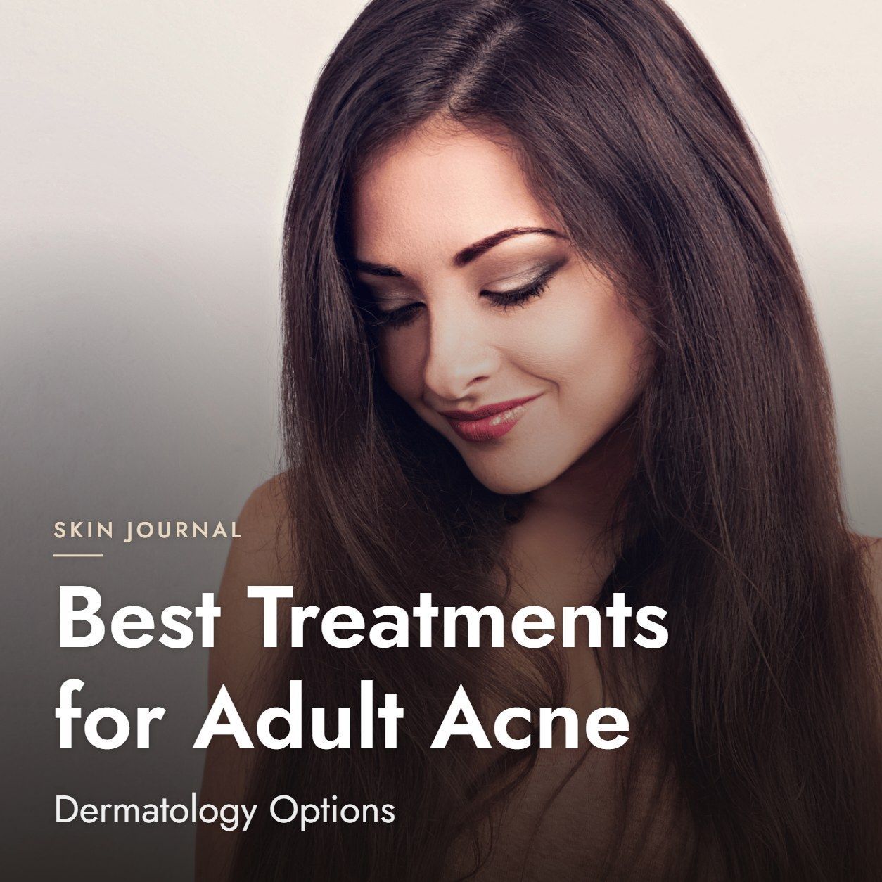 Best Treatments for Adult Acne: Dermatology Options