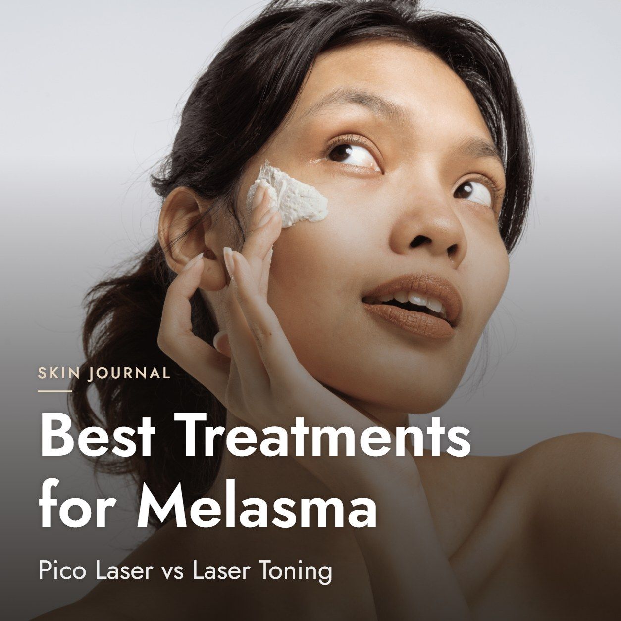 Best Treatments for Melasma: Pico Laser vs Laser Toning