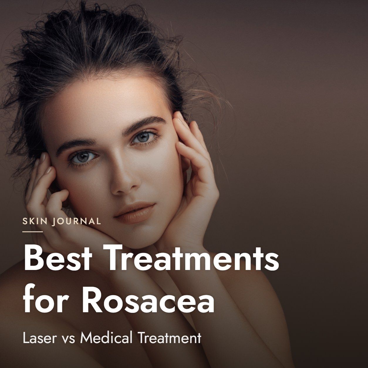 Best Treatments for Rosacea: Laser vs Medical Treatment