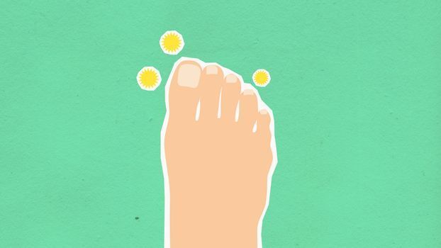 Fungal Skin Infection