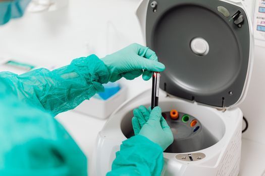 PRP Therapy