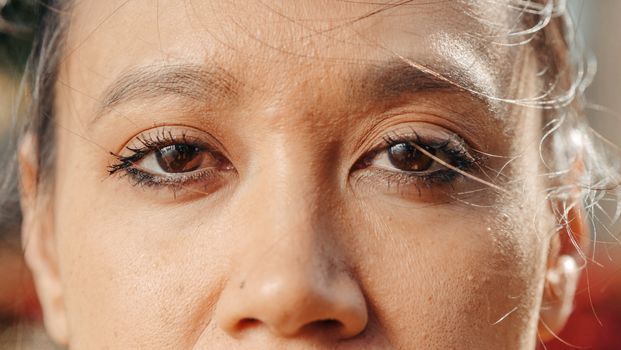 Sunken Under-Eye Filler