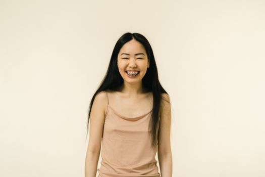 Gummy Smile Botox
