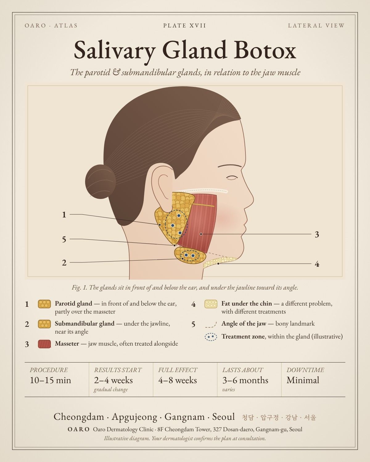 Salivary Gland Botox illustrated guide, Oaro Dermatology in Cheongdam & Apgujeong, Gangnam, Seoul