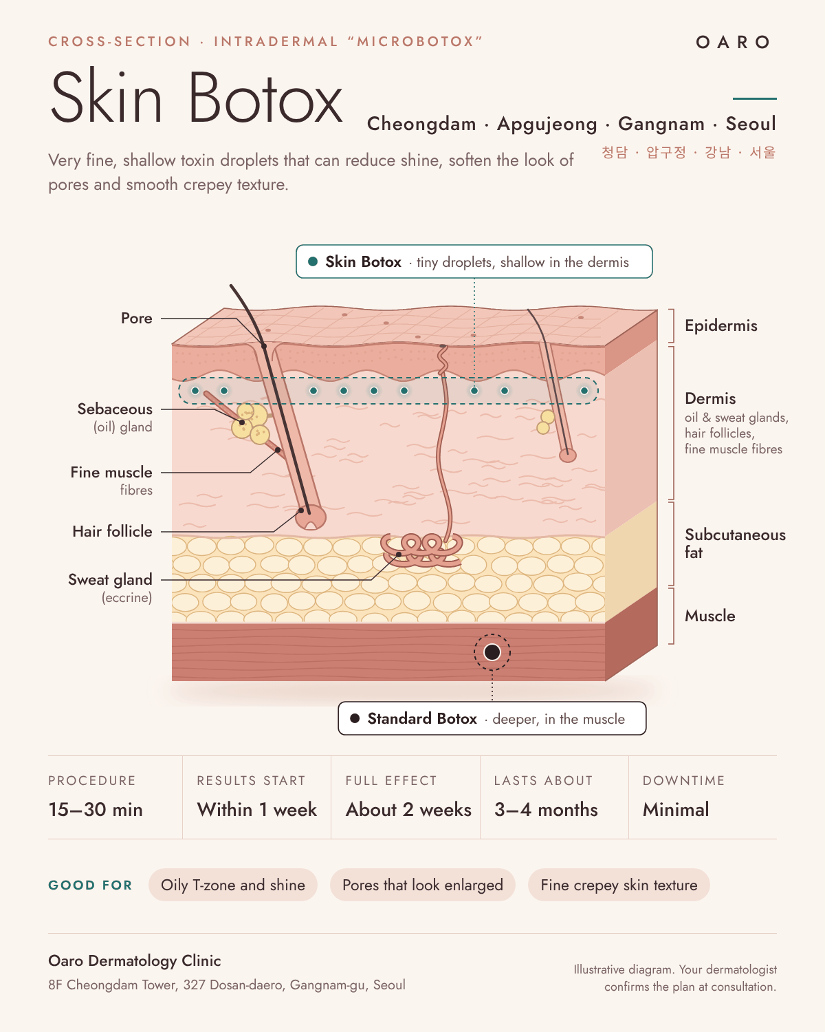 Skin Botox illustrated guide, Oaro Dermatology in Cheongdam & Apgujeong, Gangnam, Seoul