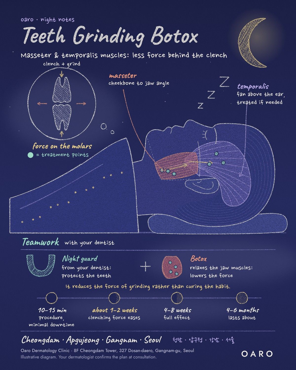 Teeth Grinding Botox illustrated guide, Oaro Dermatology in Cheongdam & Apgujeong, Gangnam, Seoul