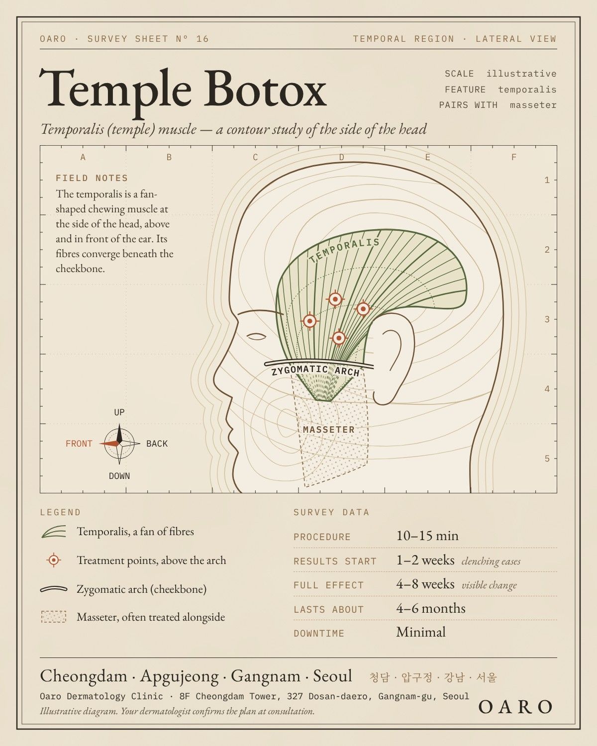 Temple Botox illustrated guide, Oaro Dermatology in Cheongdam & Apgujeong, Gangnam, Seoul
