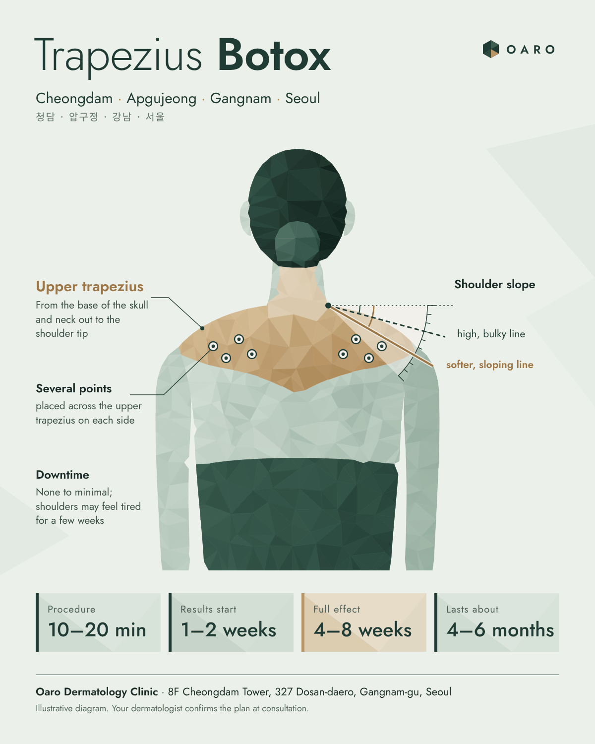 Trapezius Botox illustrated guide, Oaro Dermatology in Cheongdam & Apgujeong, Gangnam, Seoul