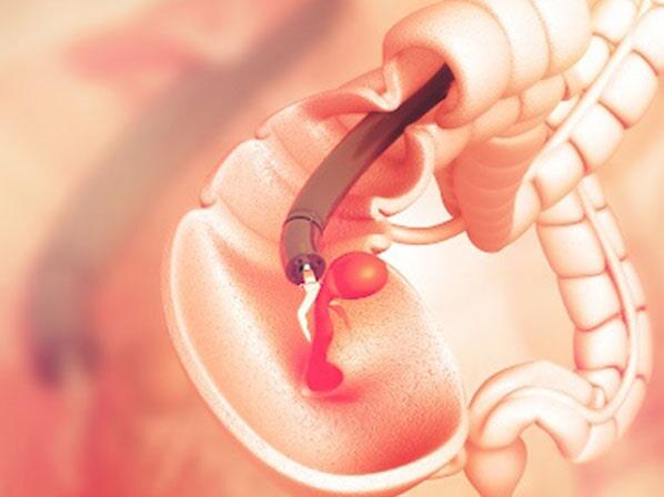 DR. JUAN MANUEL PADILLA ARRIAGA - Gastroenterología endoscópica digestiva 