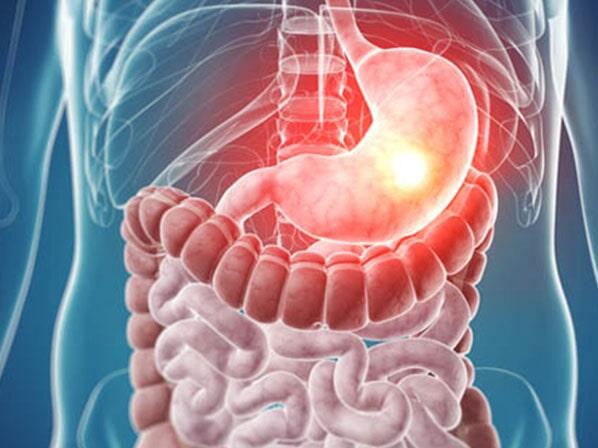 DR. JUAN MANUEL PADILLA ARRIAGA - Laparotomía 