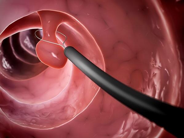 DR. JUAN MANUEL PADILLA ARRIAGA - Tratamiento no operatorio 